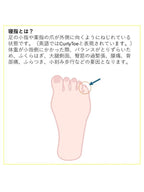 パルキュアソロジー 寝指改善テープ 1.8cmx5m [518366]｜New-HALE